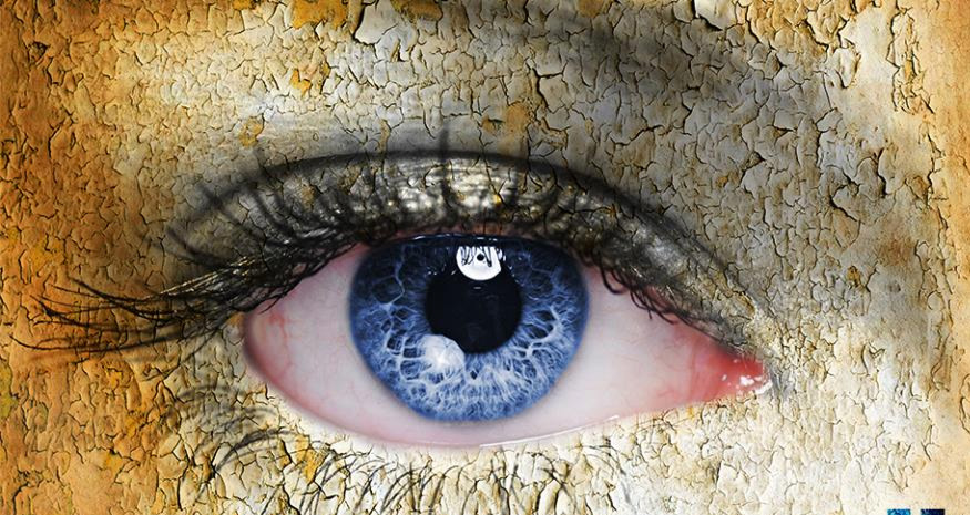 Göz Kuruluğu “Kuru Göz Sendromu” Tedavisi